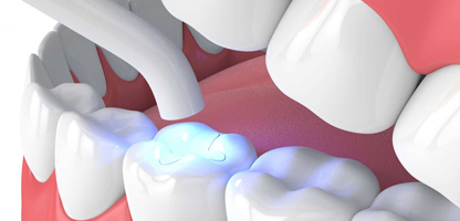 Best Dentist in Goregaon